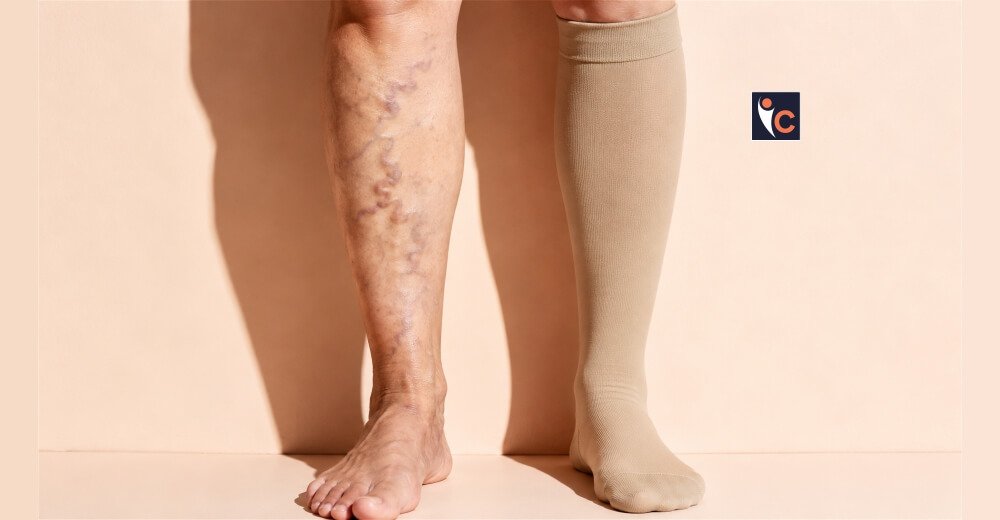 The Importance of Early Intervention in Chronic Vein Disease Care